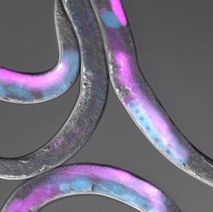 A picture of several worms is shown, overlayed with the expression pattern of two protein, TIR-1 in pink and POS-1 in blue.