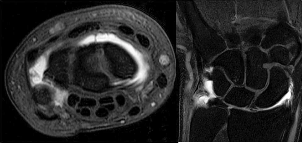 Musculoskeletal Radiology →
