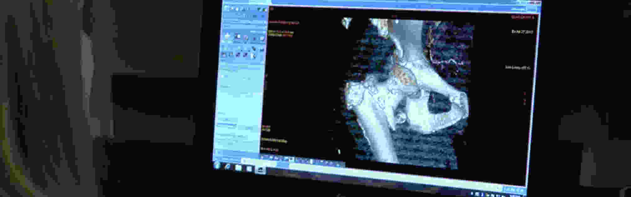 sarcoma.jpg