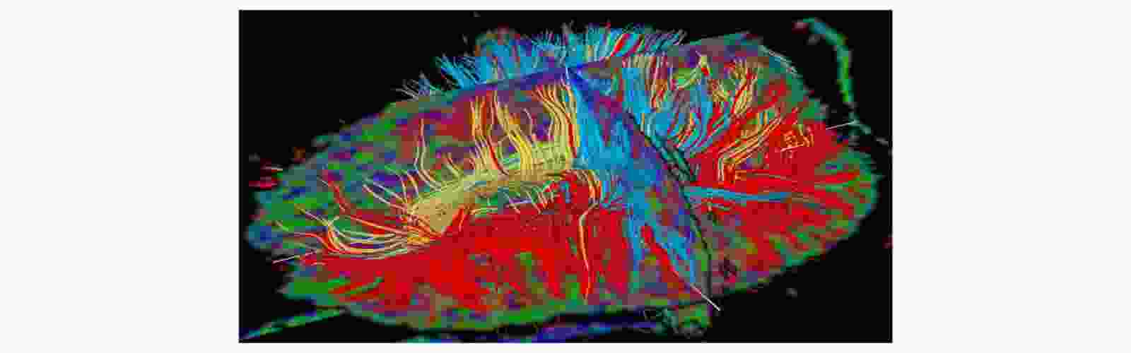 picture brain.jpg