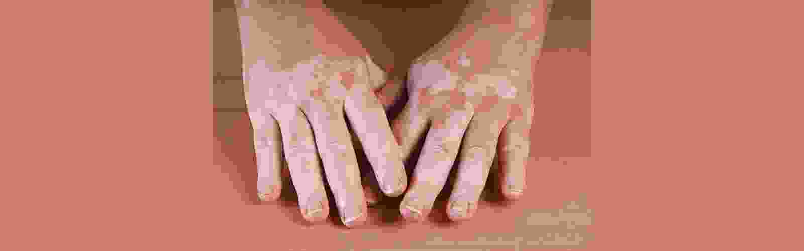 skin-core-hands-slide.png