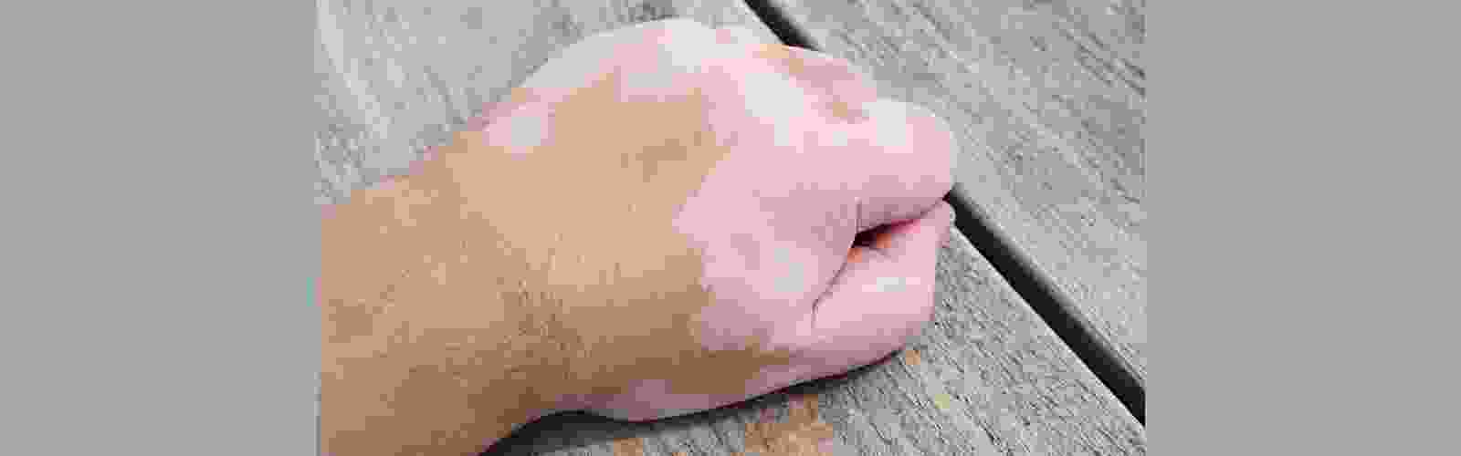 skin-core-slide1.png