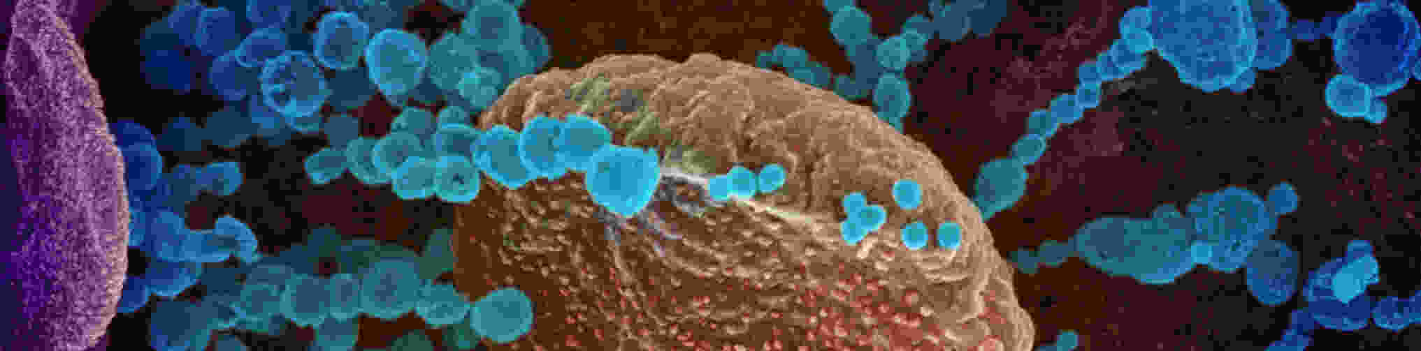 novel-coronavirus-sars-cov-2_49557550751_o.jpg